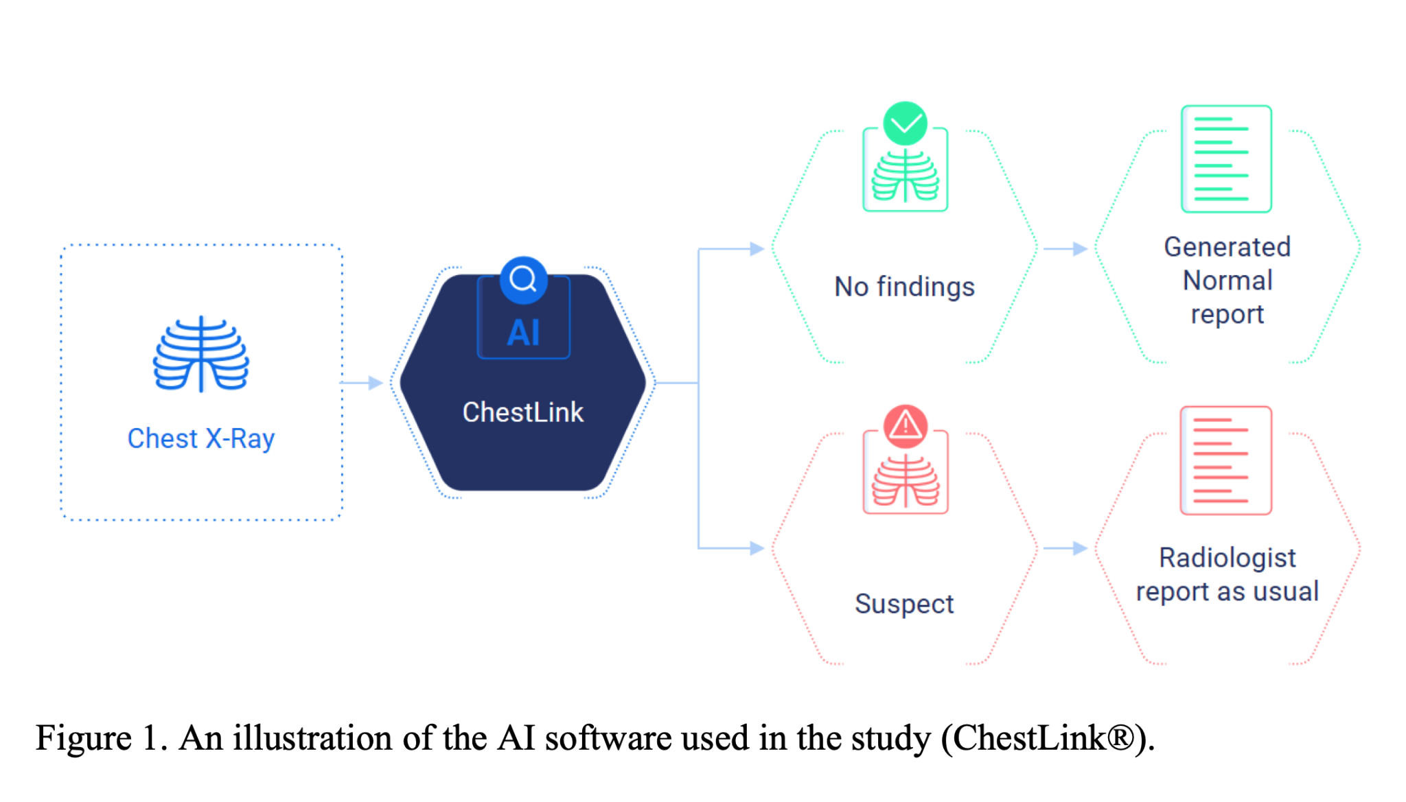 ChestLink 的工作流：判定为正常的胸片自动生成报告，其余交给放射科医生